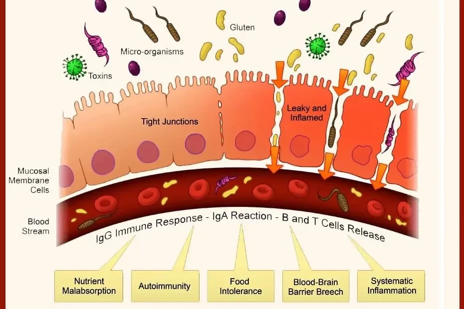 Blog-post-19-Lectins-and-Leaky-Gut