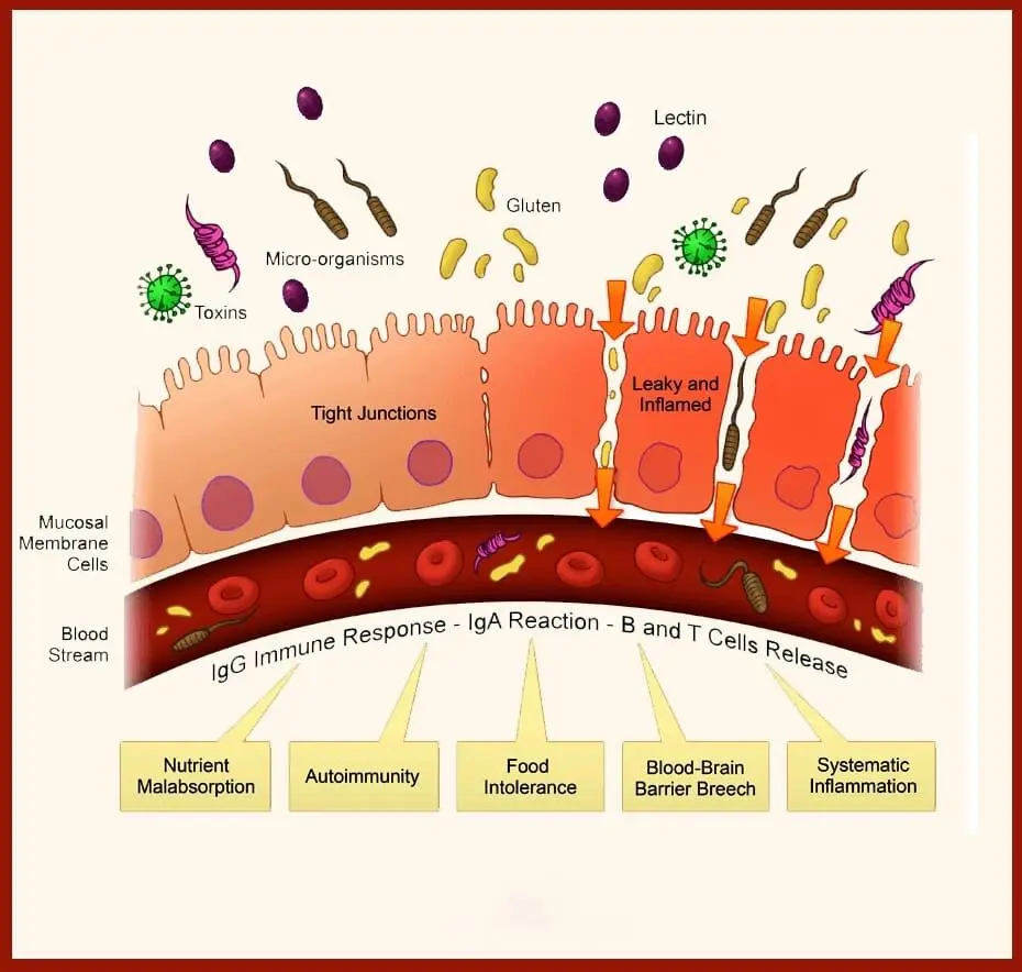 Blog-post-19-Lectins-and-Leaky-Gut